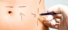 cirurgia-plastica-sao-luis-1376316292